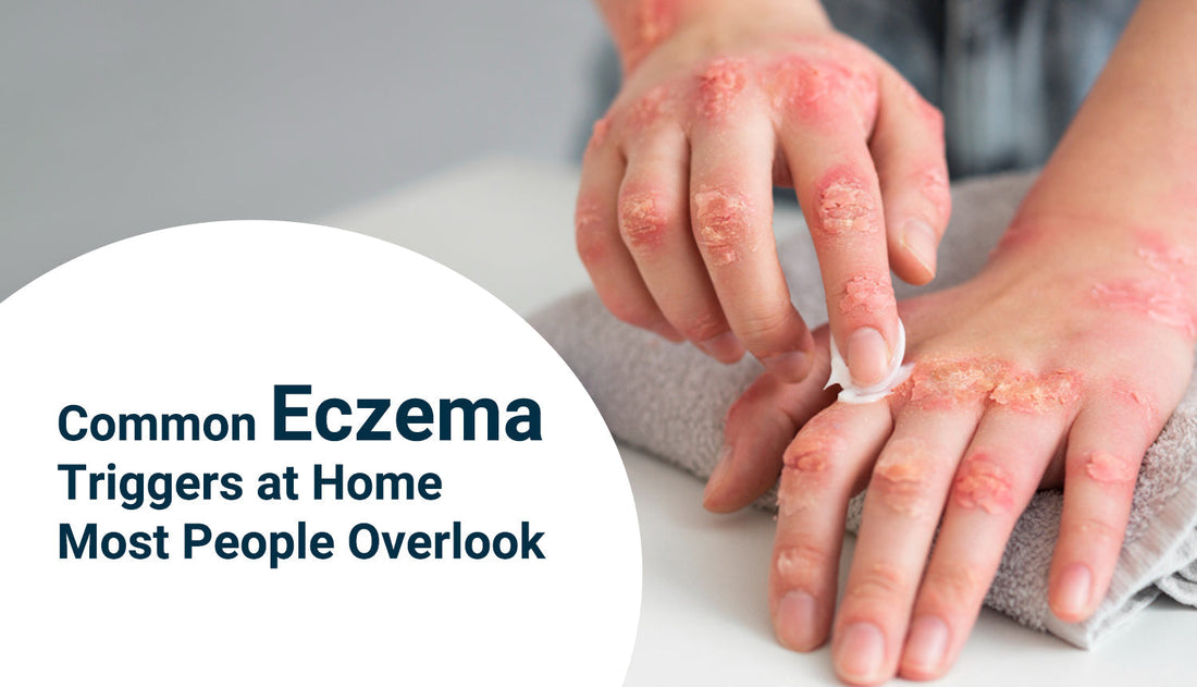 Everyday cleaning products that may trigger eczema at home