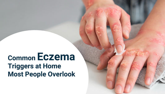 Everyday cleaning products that may trigger eczema at home