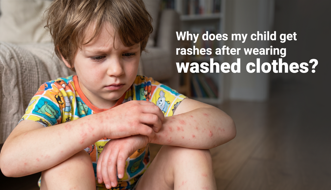 Parent-checking-child's-irritated-skin-after-wearing-washed-clothes